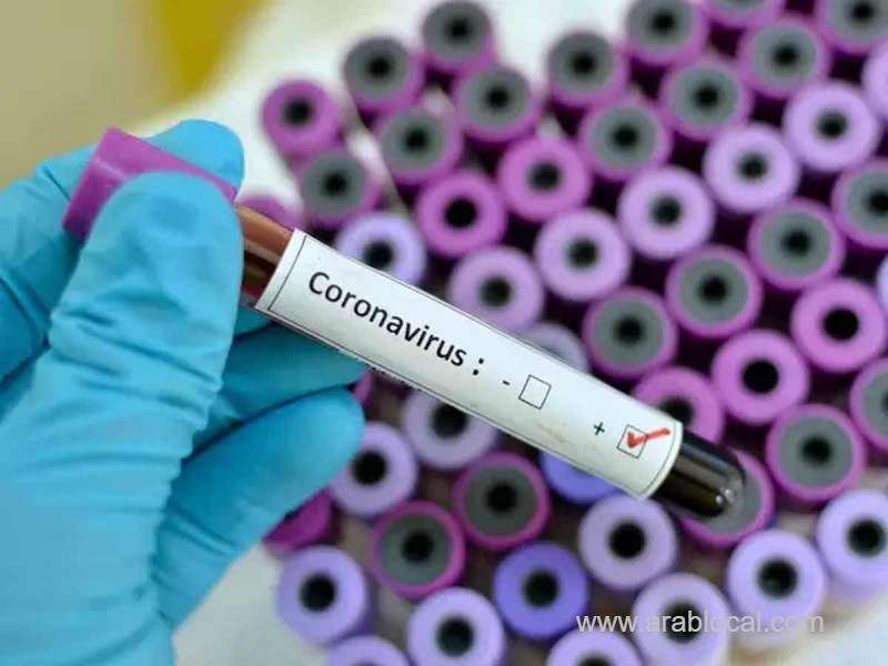 saudi-arabia-detects-5477-covid19-cases-on-sunday-saudi