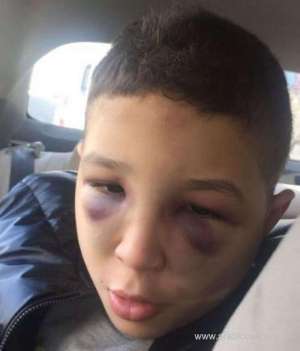 saudi-autistic-boy-was-physically-abused-at-a-center_saudi