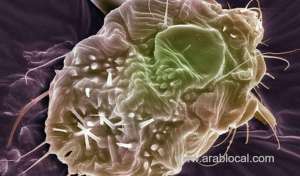 2,156-cases-of-scabies-were-reported-and-cured-in-makkah---ministry-of-health_saudi