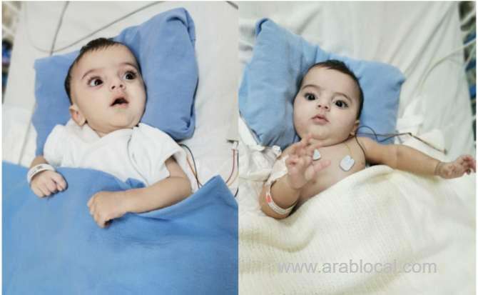 top-saudi-surgeon-visits-separated-conjoined-twins-saudi