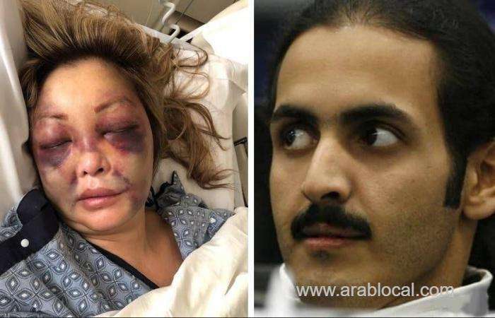 nurse-filed-a-lawsuit-against-qatar-rulers-brother-saudi