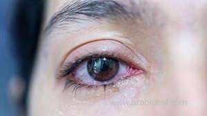 coronavirus-lingers-in-patients-eyes-days-after-it-leaves-nose_UAE